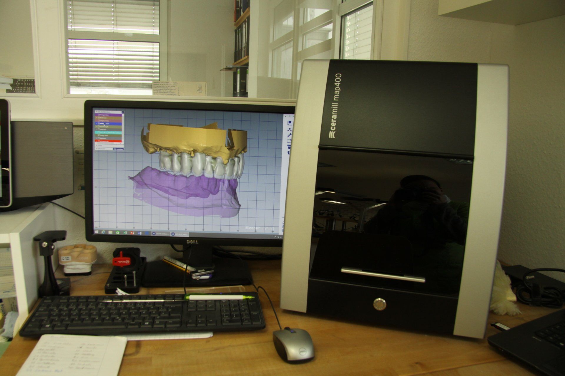 Ein Computermonitor mit einem Bild von Zähnen darauf