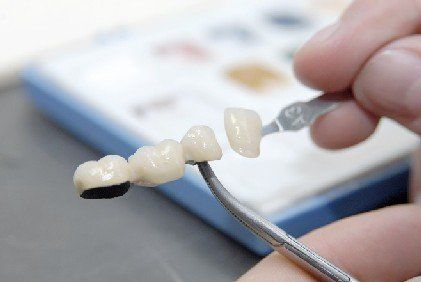 Eine Person hält eine Zahnbrücke in der Hand.