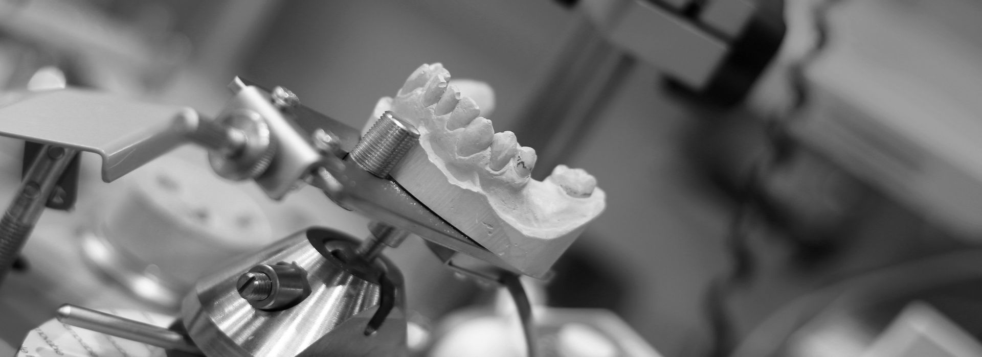 Ein Schwarzweißfoto eines Zahnmodells der Zähne einer Person.