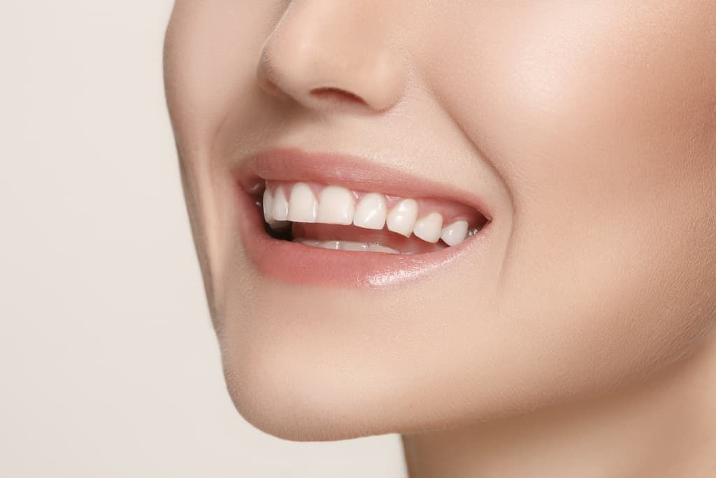 When to Consider Cosmetic Dentistry in Altamonte Springs, FL