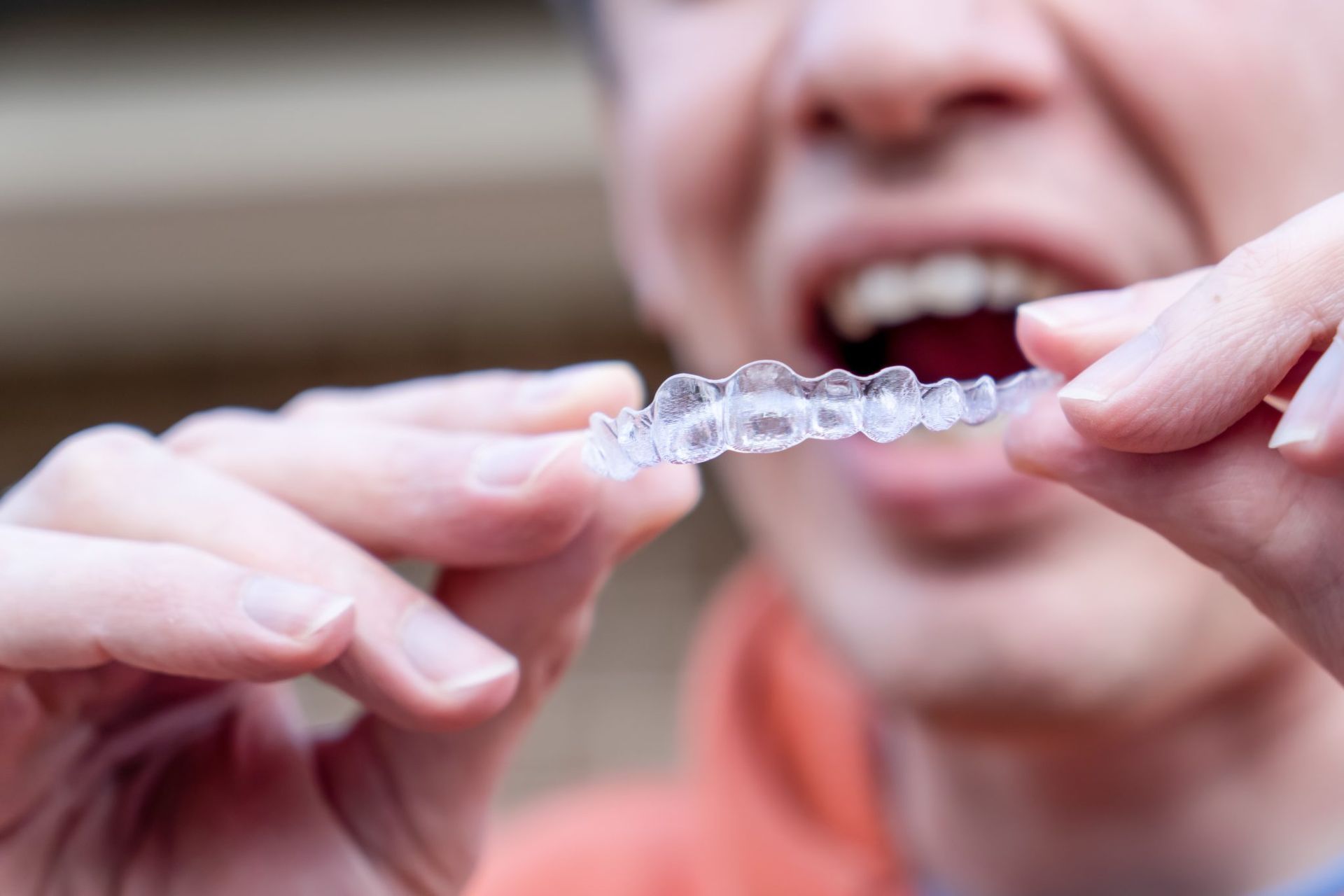 closeup of invisalign trays with a guy in the background
