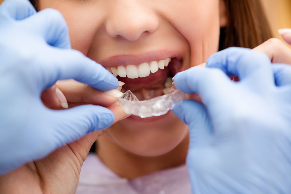 A Woman is Getting Her Teeth Straightened by a Dentist — Coronation House Dentist in Nambour, QLD