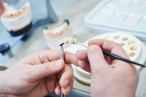 costruzione di una protesi dentale