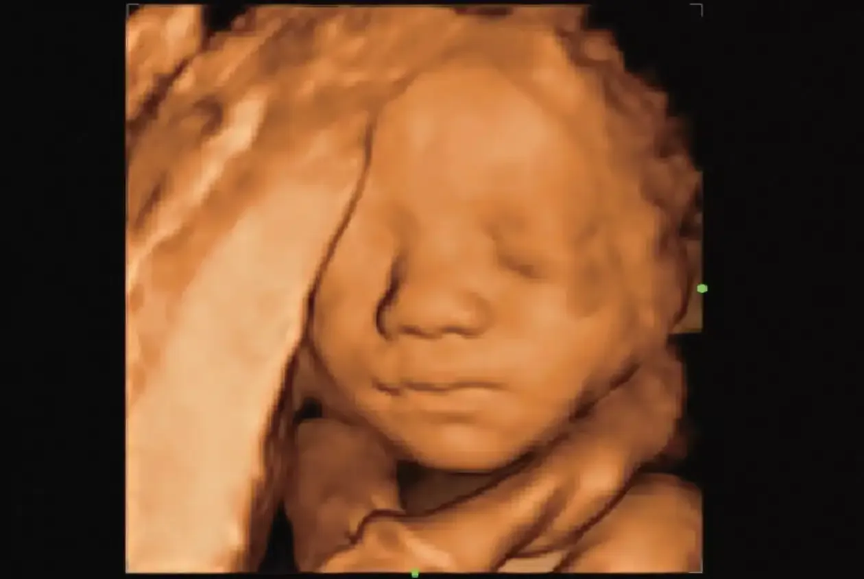 baby face ultrasound scan