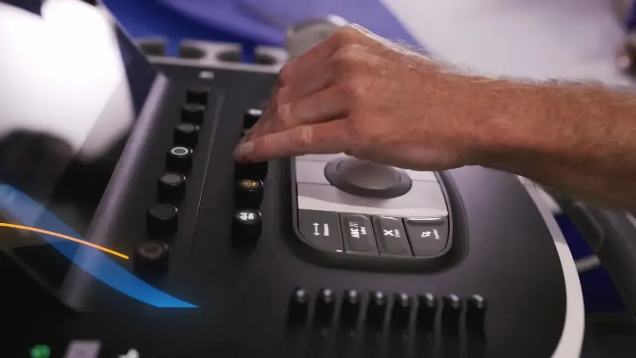 a hand using the trackball on an ultrasound machine
