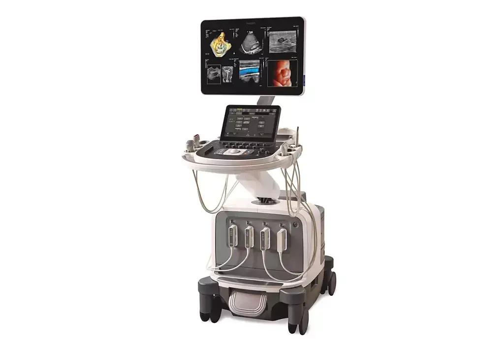a philips epiq elite ultrasound machine