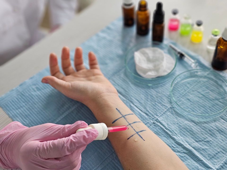 A medical worker applying a liquid to a patient's arm for allergy testing, with vials and supplies in the background.