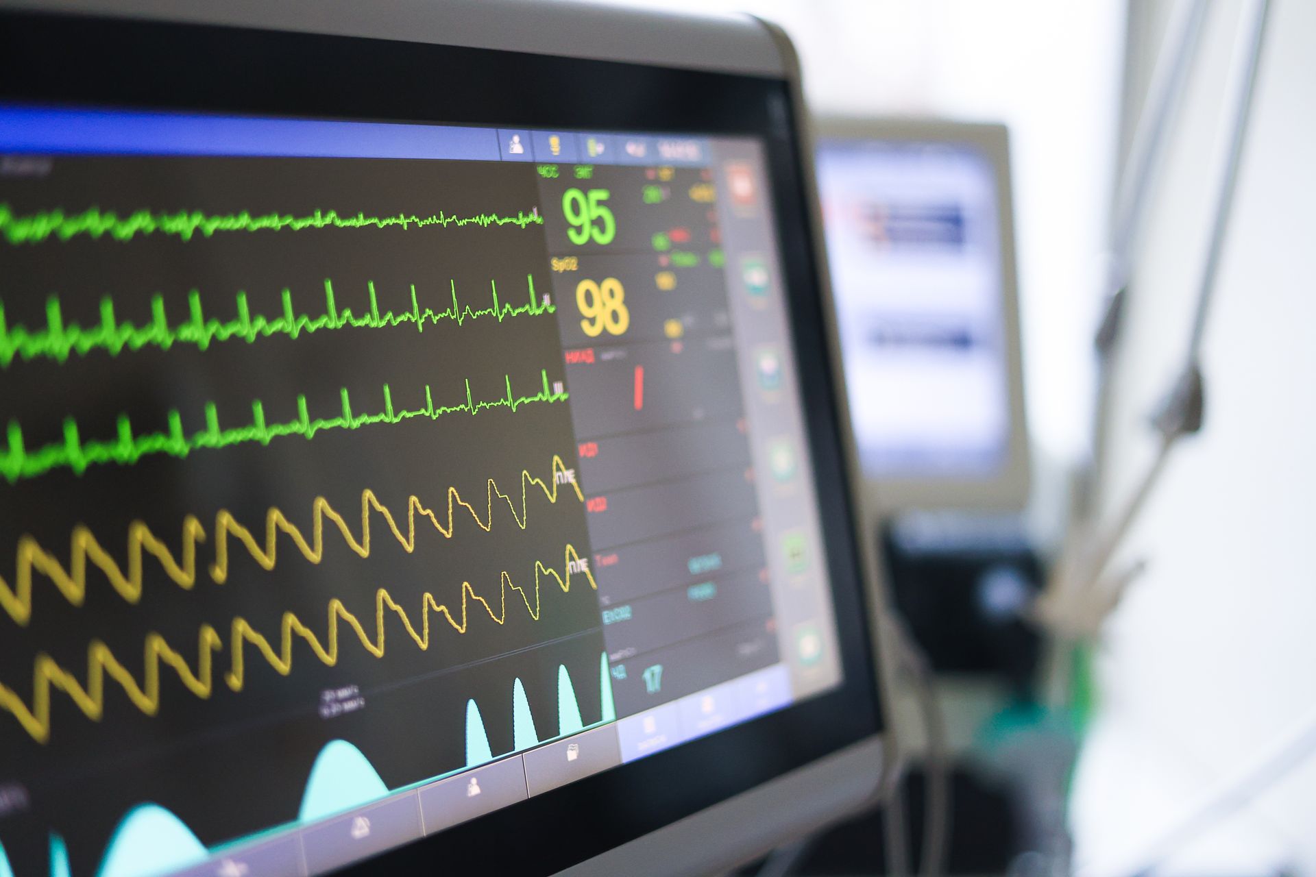 Medical monitor displaying vital signs: heart rate, oxygen saturation, and waveforms in a hospital setting.