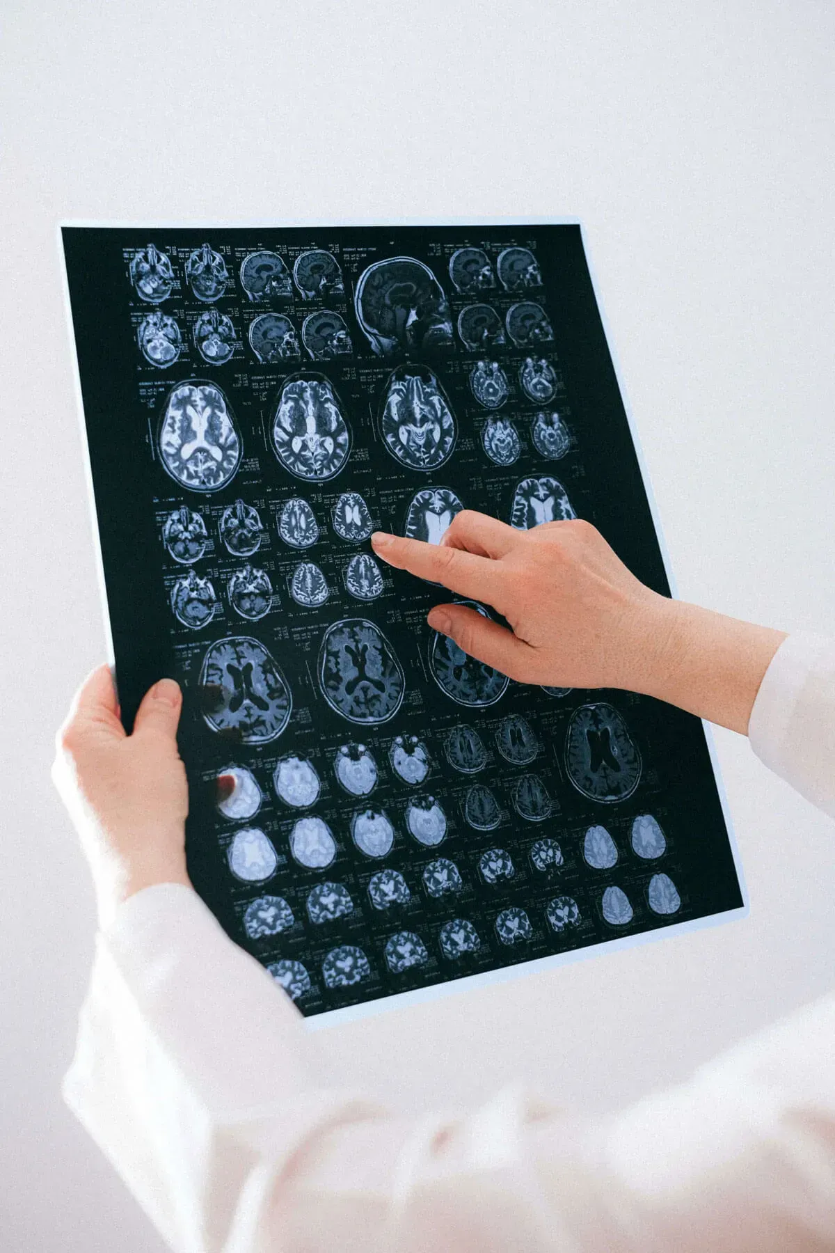 A doctor holding and pointing at brain scan images.