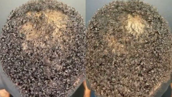 A before and after picture of a person 's hair.