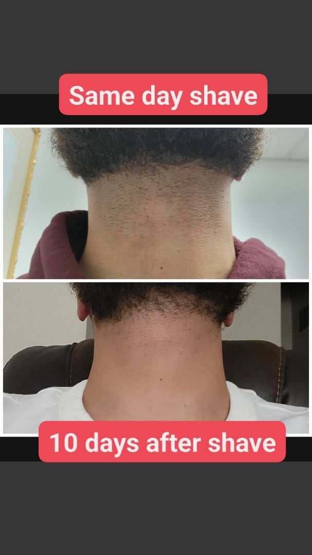 A man 's neck is shown before and after shaving it.