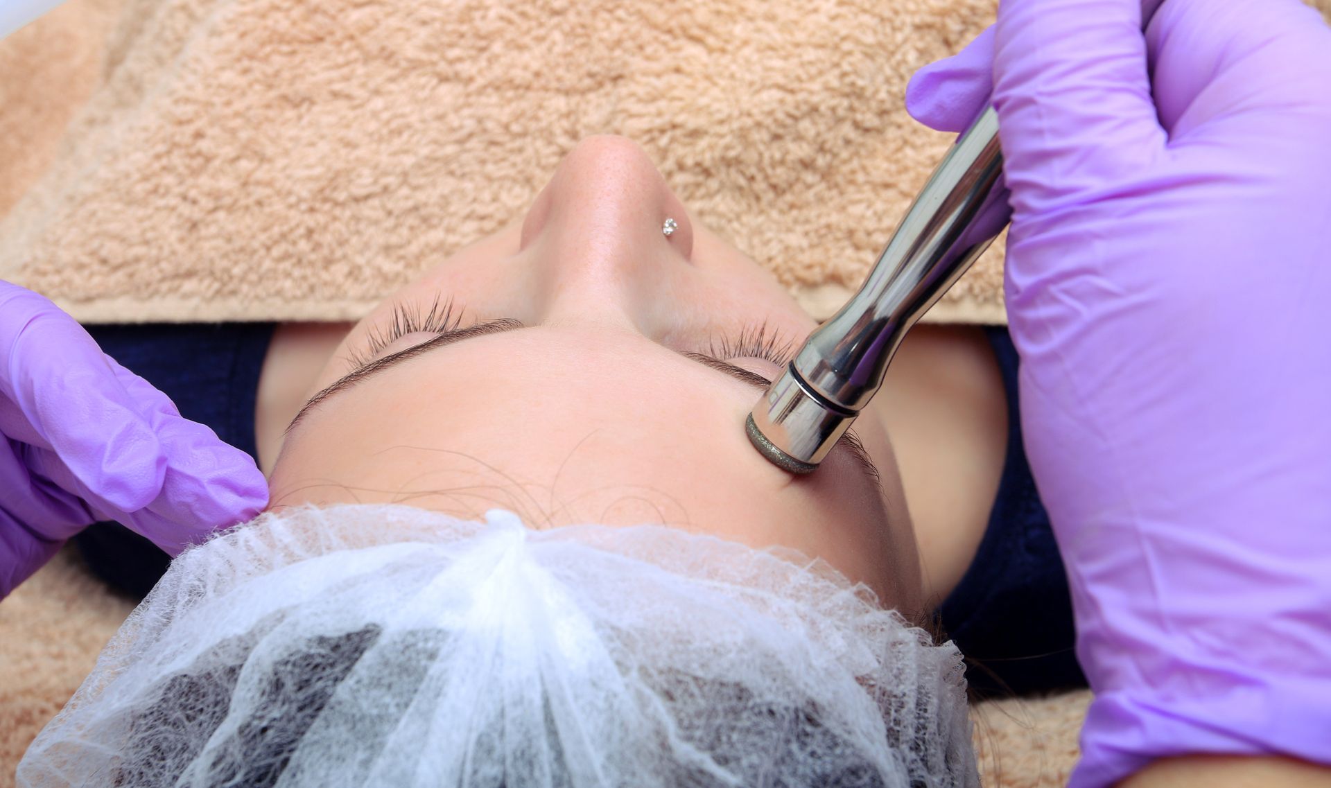 Woman having a face needling treatment.