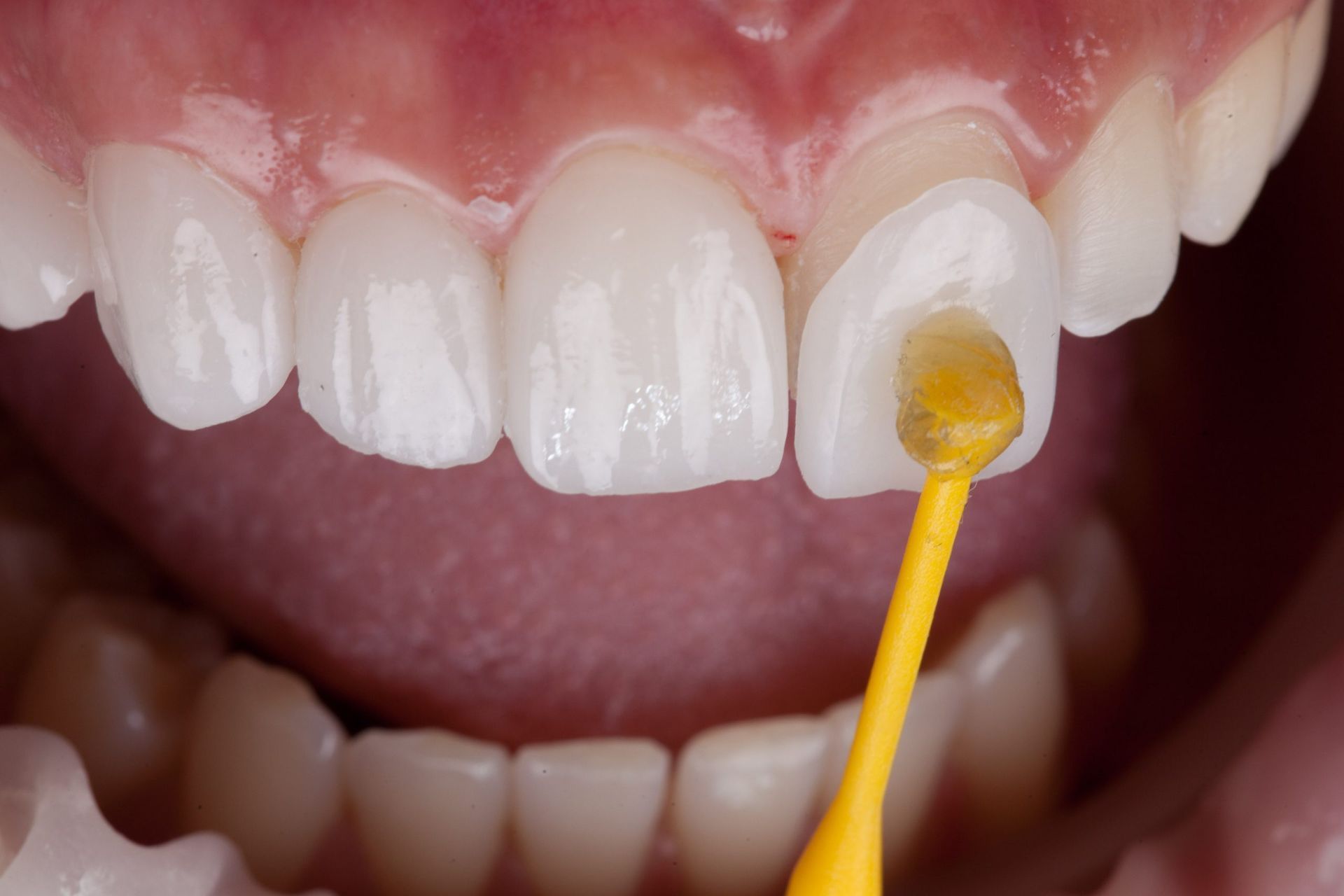 a close up of a woman 's smile with her hands on her chin .