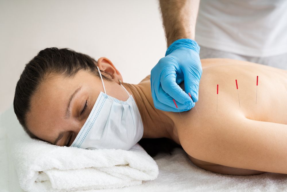 Woman Receiving Acupuncture, Wearing A Mask, Lying Face Down On A Table — Integrate Health In Ooralea, QLD