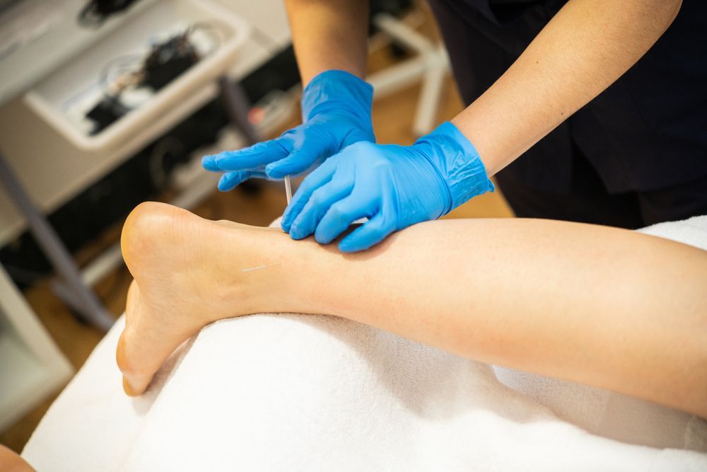 Person In Blue Gloves Inserting A Needle Into A Person's Leg, On A White Towel — Integrate Health In Ooralea, QLD