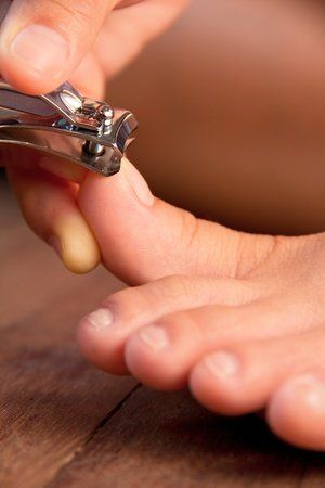5 Common Causes for Ingrown Toenails
