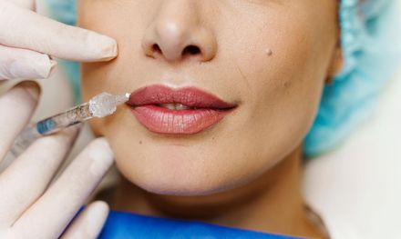 Close-up of lips being injected with filler by a gloved practitioner