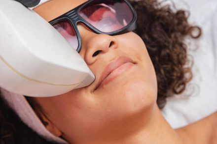 Woman receiving a facial treatment with a handheld device, wearing dark protective goggles and lying on a treatment bed