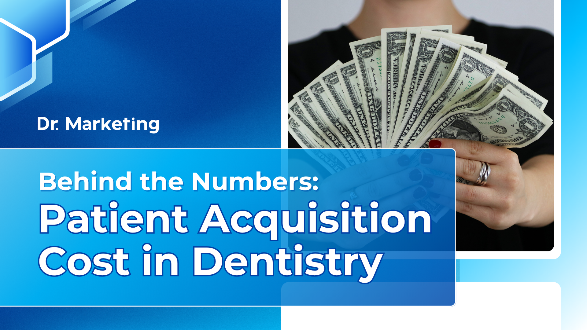 Behind the numbers patient acquisition cost in dentistry