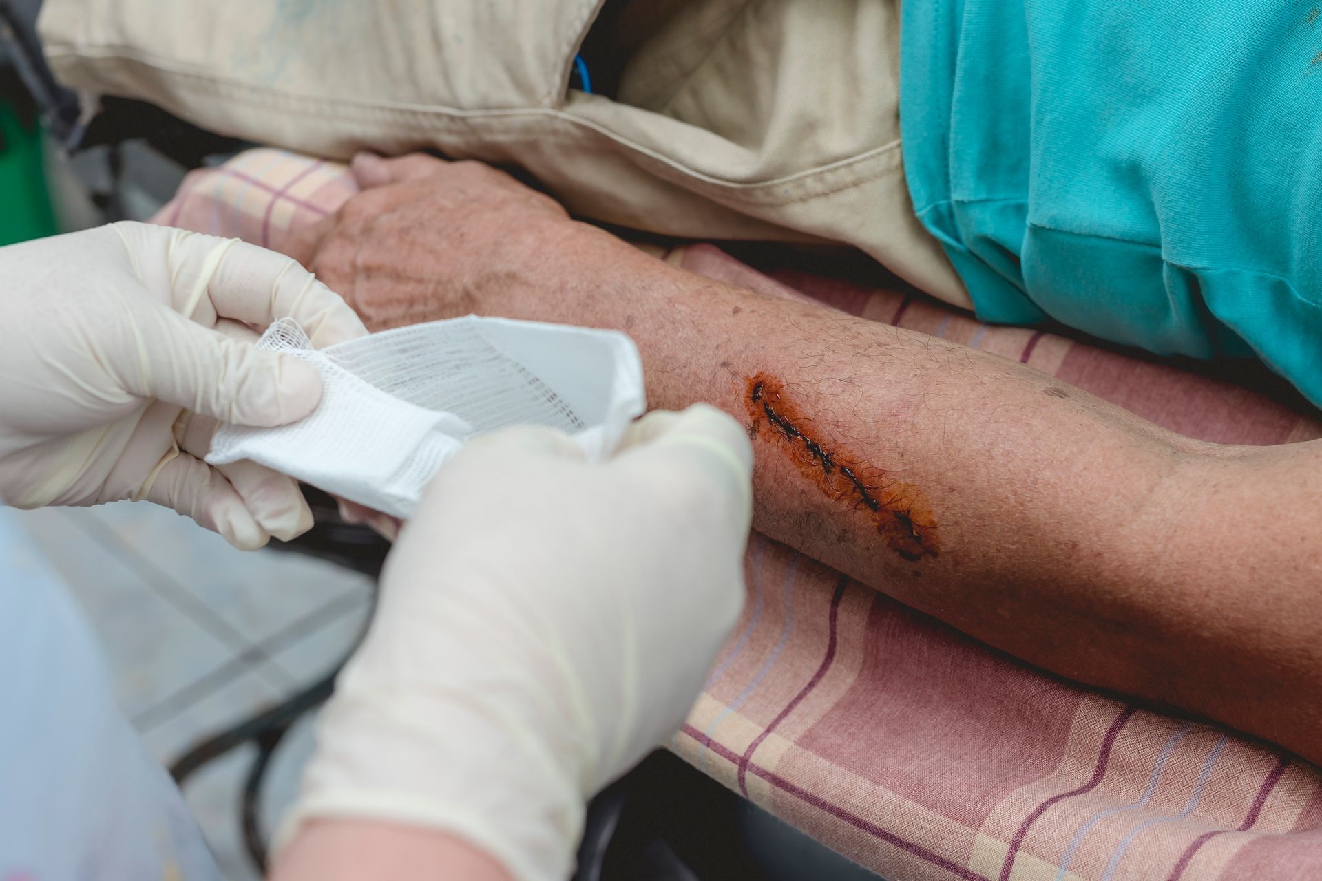 Person's arm with a healing cut is being dressed by someone wearing gloves, indoors.