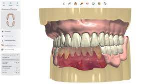 A computer generated image of a person 's teeth and gums.