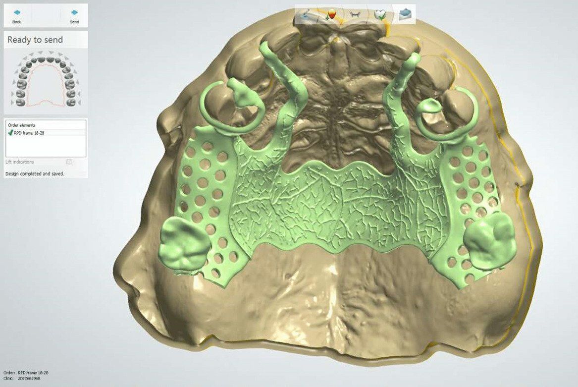 A computer generated image of a skull with a green plaque on it.