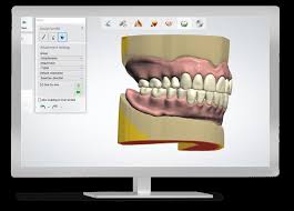A computer monitor with a model of teeth on it.