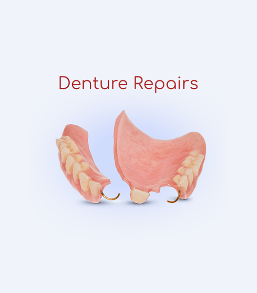 A picture of a denture with the words `` denture repairs '' written above it.