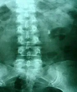 Enfermedades venéreas