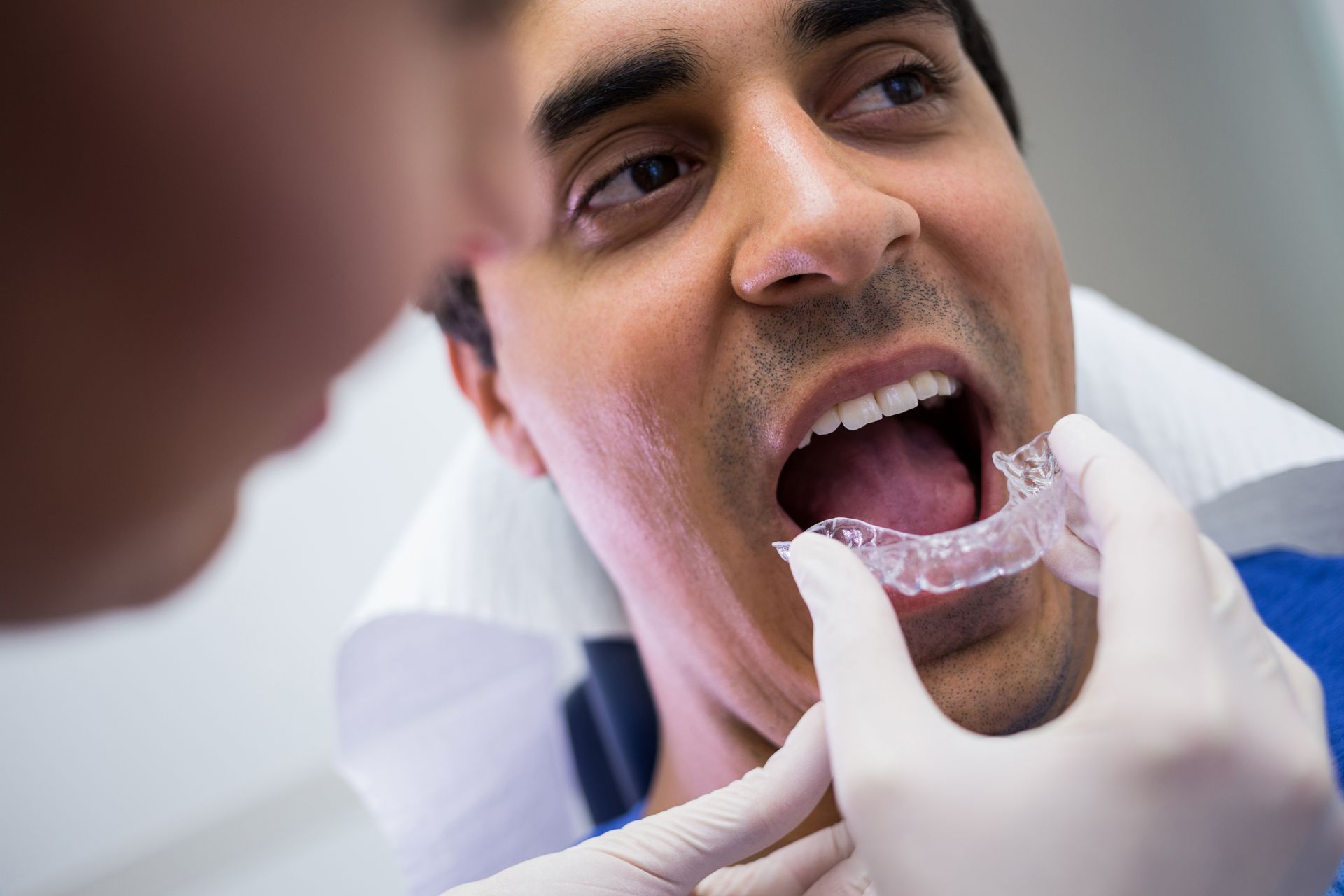 clear aligners for teeth