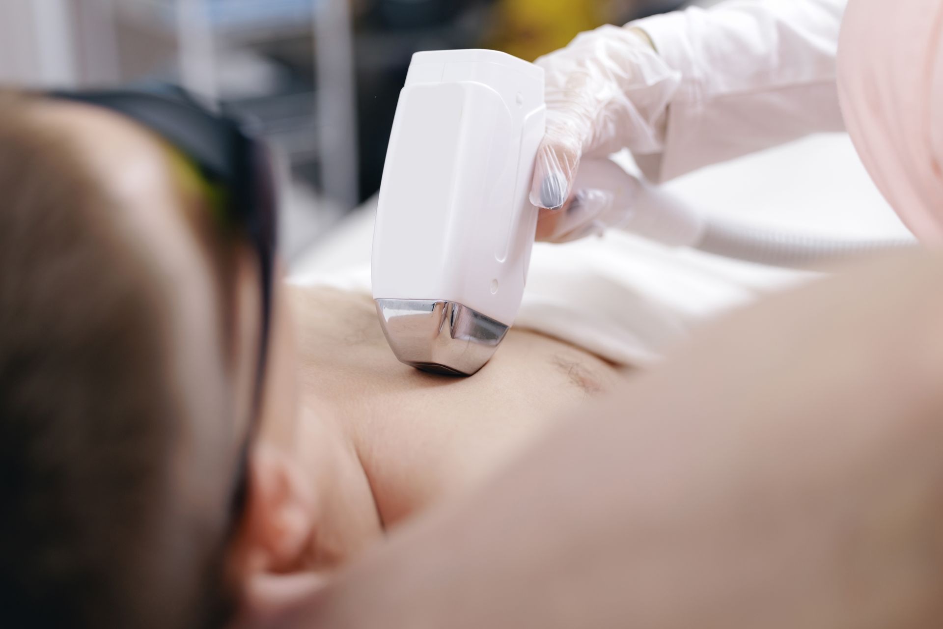 A person receiving laser hair removal treatment on their chest.
