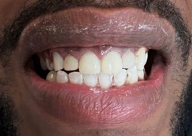 A close up of a man 's teeth with a beard.