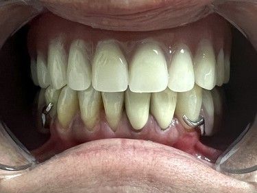 A close up of a man 's teeth with a beard.