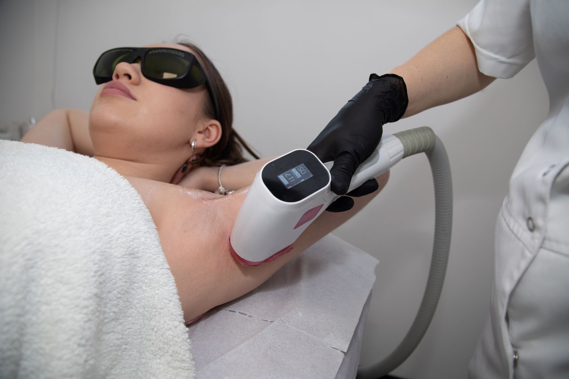 Woman receiving laser hair removal treatment on her underarm.