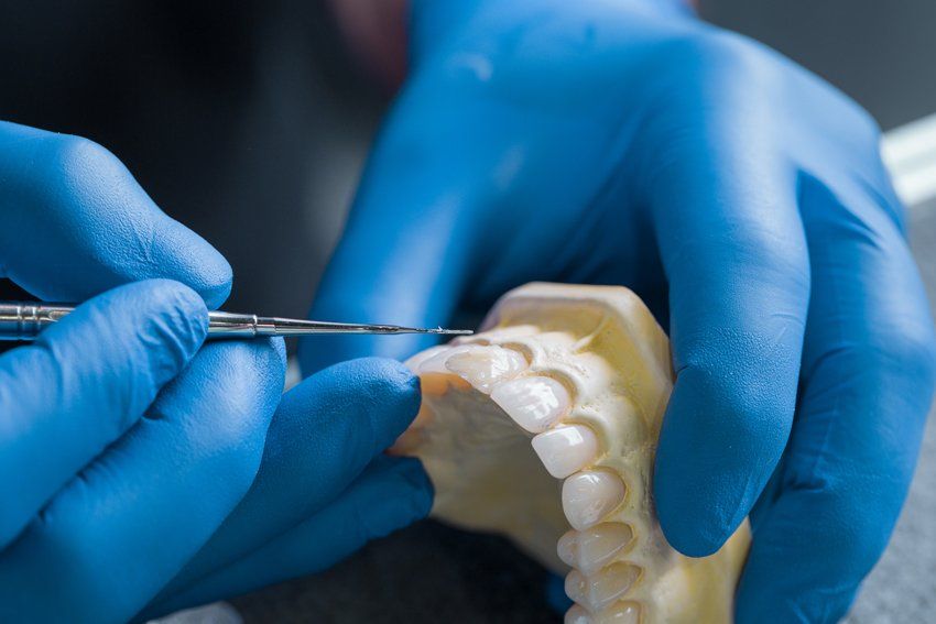 Hand Holding Dental Gypsum Models Of Upper Jaw — Jefferson, LA — Teresita V. Hernandez, DDS