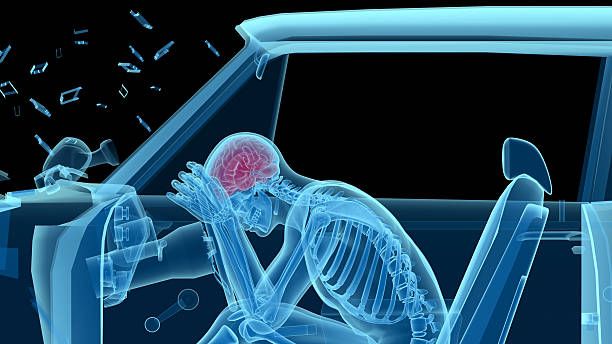 A blue, X-ray style depiction of a person inside a car, holding their head in pain after a vehicle accident.