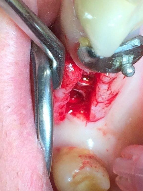 Operazione dentale