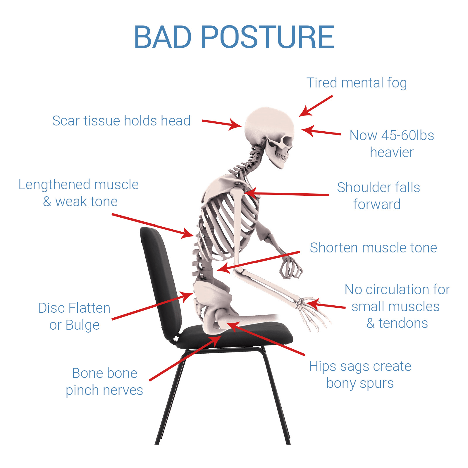 Pain a lot. Bad posture. Когнитивная эргономика. Smart posture приложение. Stepping forward posture.