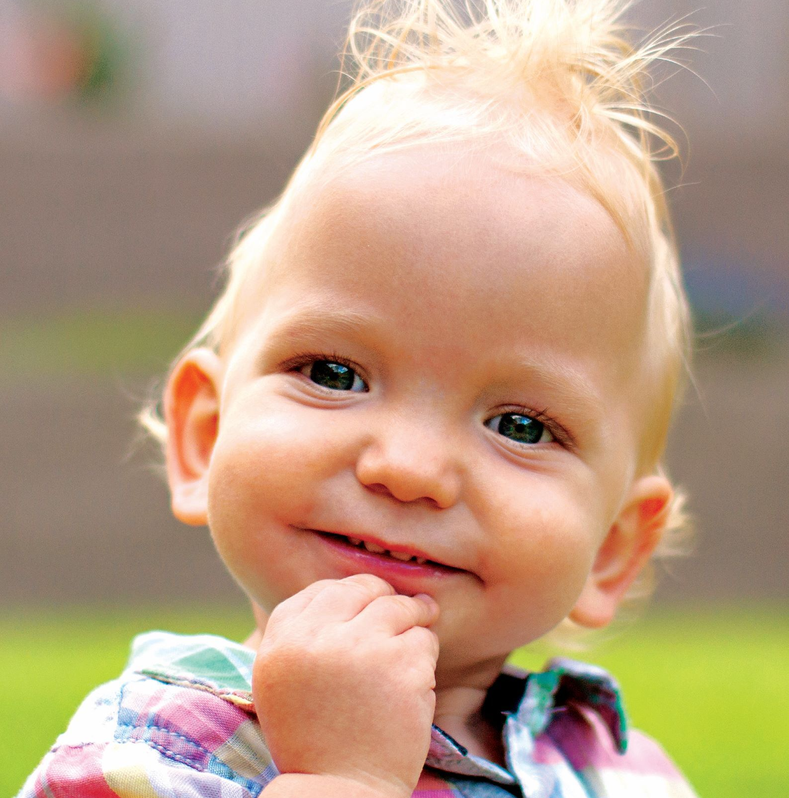 Craniofacial Australia  before Surgery image