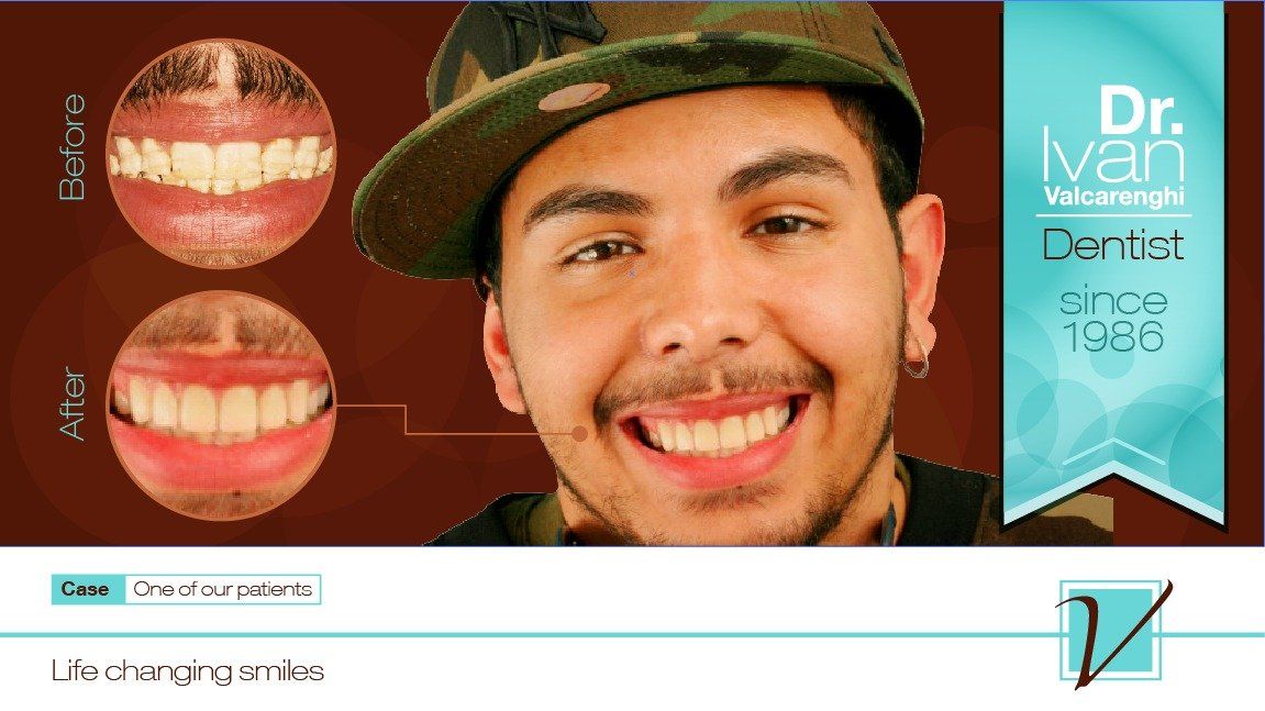 Man with Clean Teeth — Elmhurst, IL — Radiante Dental