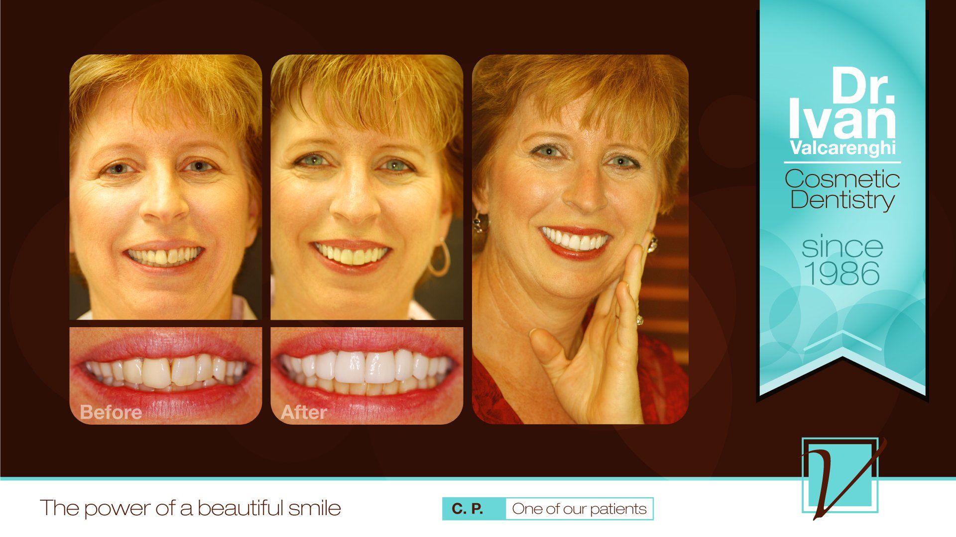Woman with a Gorgeous Smile  — Elmhurst, IL — Radiante Dental