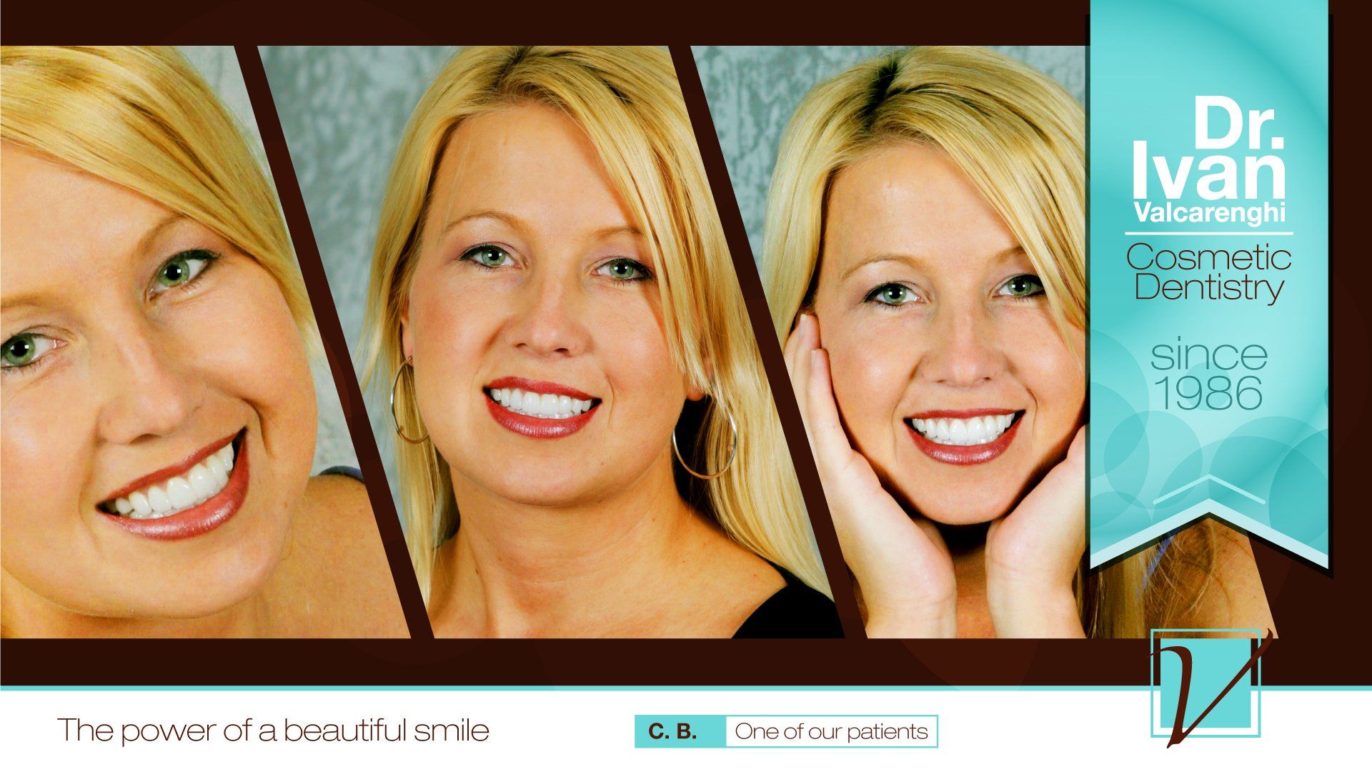Blonde Woman with White Teeth — Elmhurst, IL — Radiante Dental