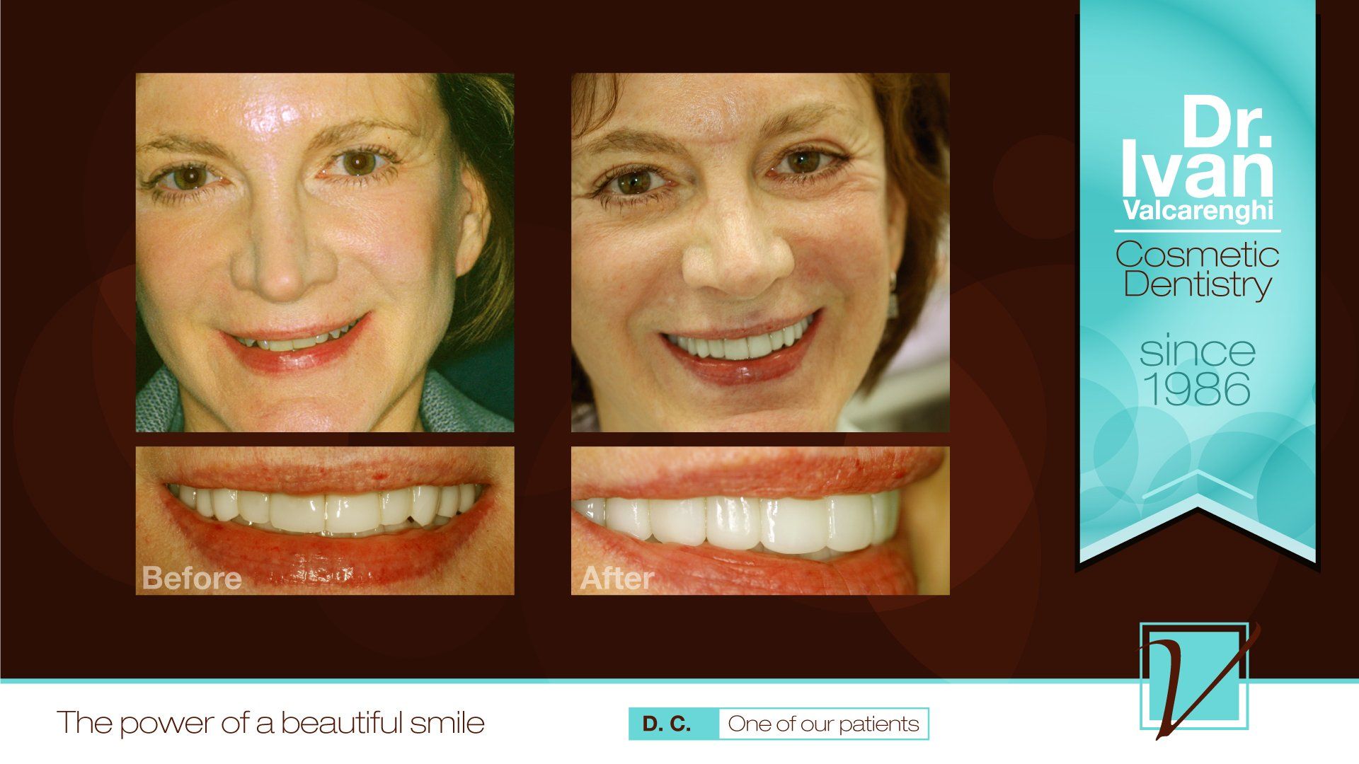 Smiling Woman — Elmhurst, IL — Radiante Dental