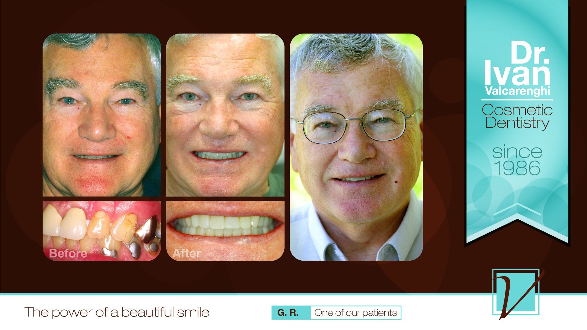 Old Man Smiling — Elmhurst, IL — Radiante Dental