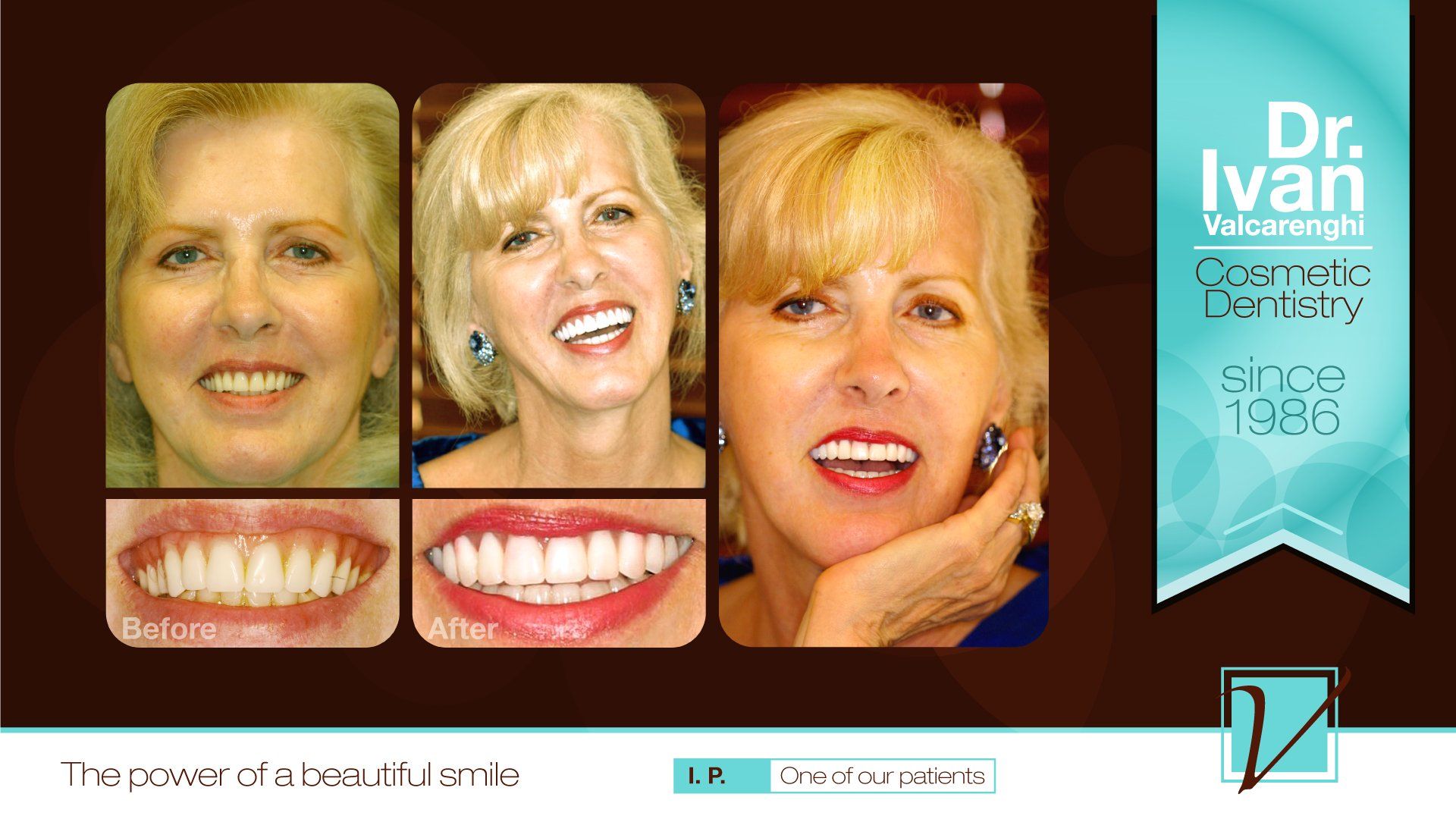 Woman with Clear Teeth — Elmhurst, IL — Radiante Dental