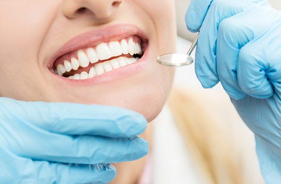 Woman With White Teeth — Elmhurst, IL — Radiante Dental