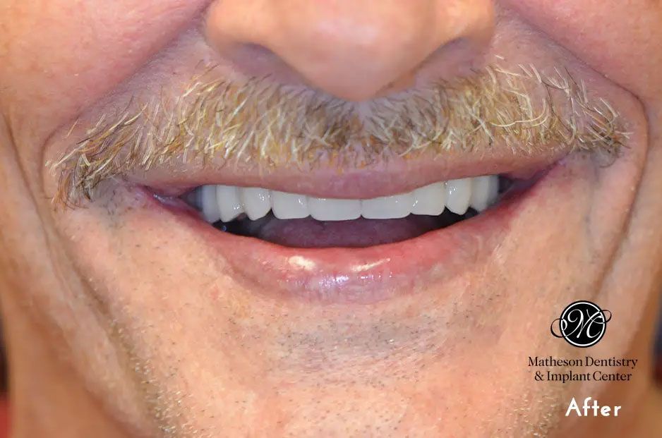 A man with a mustache and white teeth is smiling.