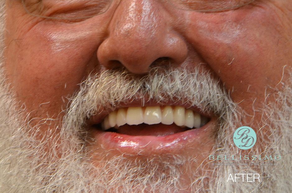 A man with a beard and mustache is smiling with his eyes closed.