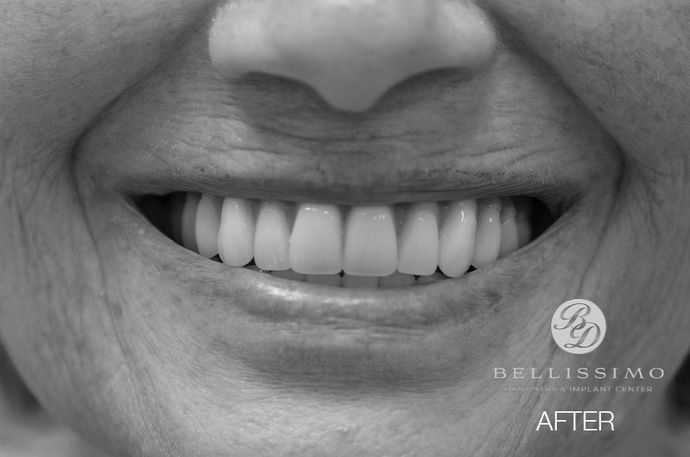 A woman 's smile is shown in a black and white photo.