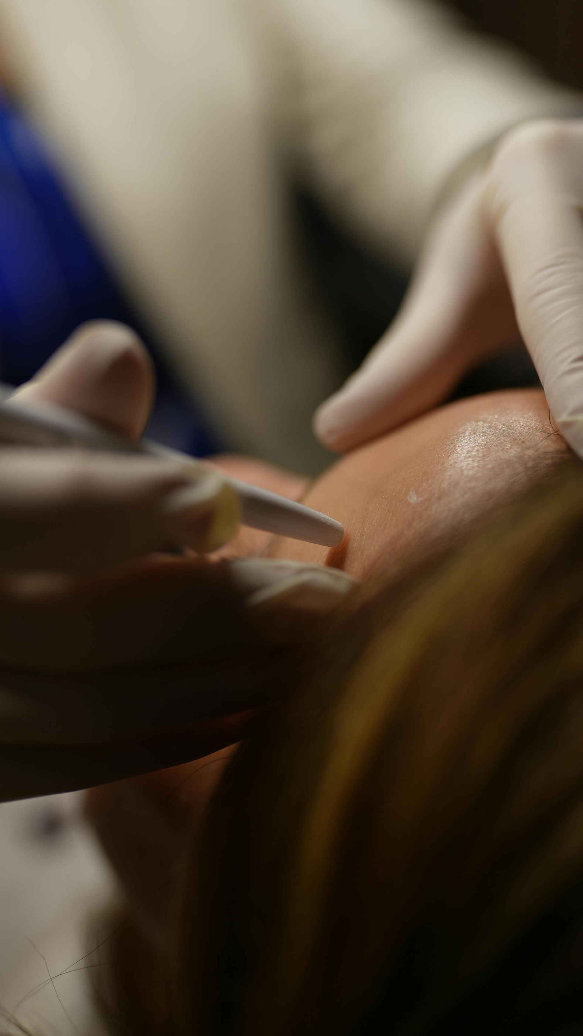 Un profesional, con guantes, utiliza una herramienta fina y blanca para realizar un procedimiento cosmético facial preciso a un cliente.